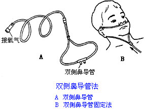 ◆肺病患者如何家庭氧疗？